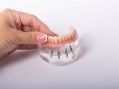 Базальная имплантация — решение для пациентов с недостатком костной ткани